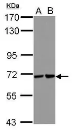 Anti-Sts1 antibody [N2C1], Internal used in Western Blot (WB). GTX122044