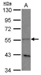 Anti-PLD3 antibody [N1C1] used in Western Blot (WB). GTX122218