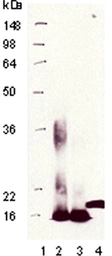 Anti-Metallothionein antibody [UC1MT] used in Western Blot (WB). GTX12228