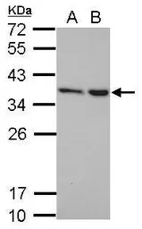 Anti-NIP30 antibody used in Western Blot (WB). GTX122479