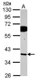 Anti-SDF4 antibody used in Western Blot (WB). GTX122508
