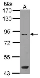 Anti-SAMD4B antibody used in Western Blot (WB). GTX122549