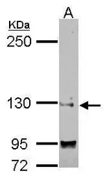 Anti-SAP130 antibody [N1N2], N-term used in Western Blot (WB). GTX122554