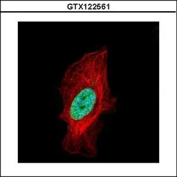 Anti-Histone H1.2 antibody used in Immunocytochemistry/ Immunofluorescence (ICC/IF). GTX122561