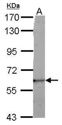 Anti-LRRC50 antibody used in Western Blot (WB). GTX122620
