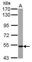 Anti-Plexin A4 antibody [N1], N-term used in Western Blot (WB). GTX122632