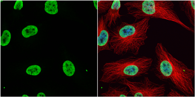 Anti-Histone H3K9K14ac (Acetyl Lys9/Lys14) antibody used in Immunocytochemistry/ Immunofluorescence (ICC/IF). GTX122648