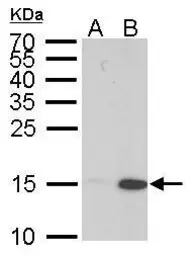 Anti-Histone H3K9K14ac (Acetyl Lys9/Lys14) antibody used in Western Blot (WB). GTX122648