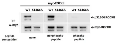 Anti-ROCK2 (phospho Ser1366) antibody used in Western Blot (WB). GTX122651
