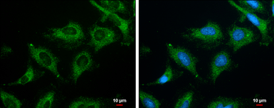Anti-ROCK2 (phospho Ser1366) antibody used in Immunocytochemistry/ Immunofluorescence (ICC/IF). GTX122651