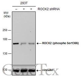 Anti-ROCK2 (phospho Ser1366) antibody used in Western Blot (WB). GTX122651