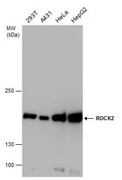 Anti-ROCK2 antibody used in Western Blot (WB). GTX122652