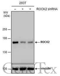 Anti-ROCK2 antibody used in Western Blot (WB). GTX122652