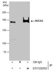 Anti-ROCK2 antibody used in Immunoprecipitation (IP). GTX122652
