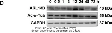 Anti-ARL13B antibody used in Western Blot (WB). GTX122703
