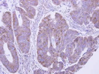Anti-LACTB2 antibody used in IHC (Paraffin sections) (IHC-P). GTX122755