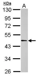 Anti-BAF53B antibody used in Western Blot (WB). GTX122920