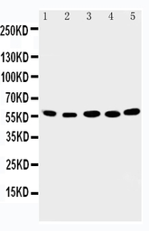 Anti-ABI2 antibody used in Western Blot (WB). GTX12303