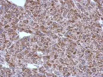 Anti-ACSM1 antibody used in IHC (Paraffin sections) (IHC-P). GTX123303