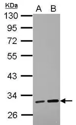 Anti-LRRC19 antibody used in Western Blot (WB). GTX123305