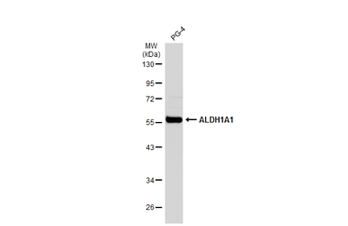 Anti-ALDH1A1 antibody used in Western Blot (WB). GTX123426