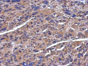 Anti-ADAMTS5 antibody [N3C2], Internal used in IHC (Paraffin sections) (IHC-P). GTX123657