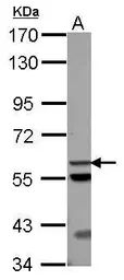 Anti-ACOT12 antibody used in Western Blot (WB). GTX123722