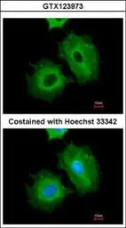 Anti-ALDH1A1 antibody used in Immunocytochemistry/ Immunofluorescence (ICC/IF). GTX123973
