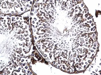 Anti-GFM2 antibody used in IHC (Paraffin sections) (IHC-P). GTX124071