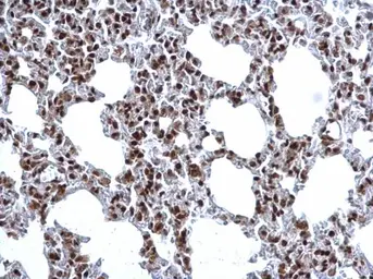 Anti-Histone H3R17me2 (Asymmetric Di-methyl Arg17) antibody used in IHC (Paraffin sections) (IHC-P). GTX124113
