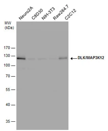 Anti-DLK/MAP3K12 antibody used in Western Blot (WB). GTX124127