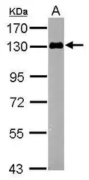 Anti-DLK/MAP3K12 antibody used in Western Blot (WB). GTX124127