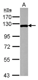 Anti-DLK/MAP3K12 antibody used in Western Blot (WB). GTX124127