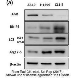 Anti-ATG12 antibody used in Western Blot (WB). GTX124181
