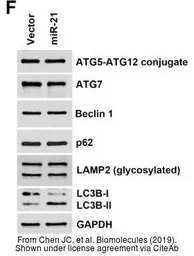 Anti-ATG12 antibody used in Western Blot (WB). GTX124181