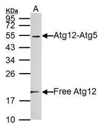 Anti-ATG12 antibody used in Western Blot (WB). GTX124181