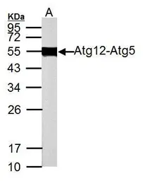 Anti-ATG12 antibody used in Western Blot (WB). GTX124181
