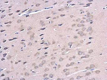 Anti-ATG12 antibody used in IHC (Paraffin sections) (IHC-P). GTX124181