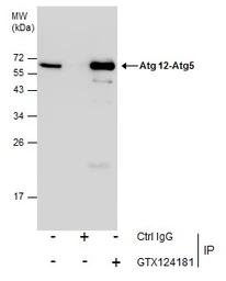 Anti-ATG12 antibody used in Immunoprecipitation (IP). GTX124181