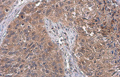 Anti-ATG12 antibody used in IHC (Paraffin sections) (IHC-P). GTX124181