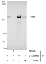Anti-CHD4 antibody used in Immunoprecipitation (IP). GTX124186