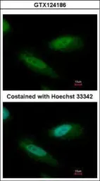 Anti-CHD4 antibody used in Immunocytochemistry/ Immunofluorescence (ICC/IF). GTX124186