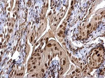 Anti-CHD4 antibody used in IHC (Paraffin sections) (IHC-P). GTX124186