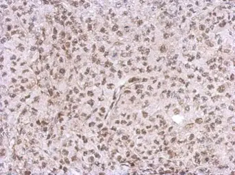 Anti-CHD4 antibody used in IHC (Paraffin sections) (IHC-P). GTX124186