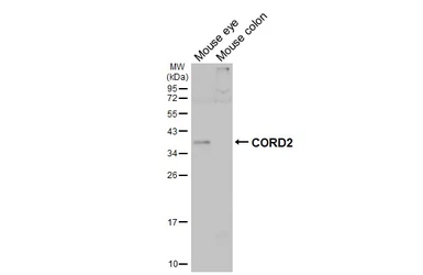 Anti-CORD2 antibody used in Western Blot (WB). GTX124188