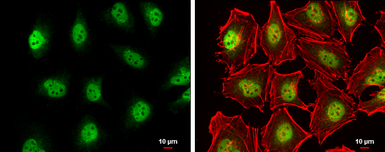 Anti-TET2 antibody [N2], N-term used in Immunocytochemistry/ Immunofluorescence (ICC/IF). GTX124204