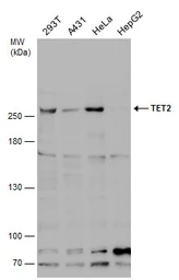 Anti-TET2 antibody [N2], N-term used in Western Blot (WB). GTX124204