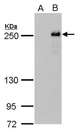 Anti-TET2 antibody [N2], N-term used in Western Blot (WB). GTX124204