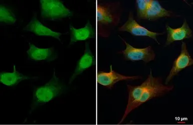 Anti-TET1 antibody [N3C1] used in Immunocytochemistry/ Immunofluorescence (ICC/IF). GTX124207