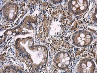 Anti-iNOS antibody [N1N2-2], N-term used in IHC (Paraffin sections) (IHC-P). GTX124210